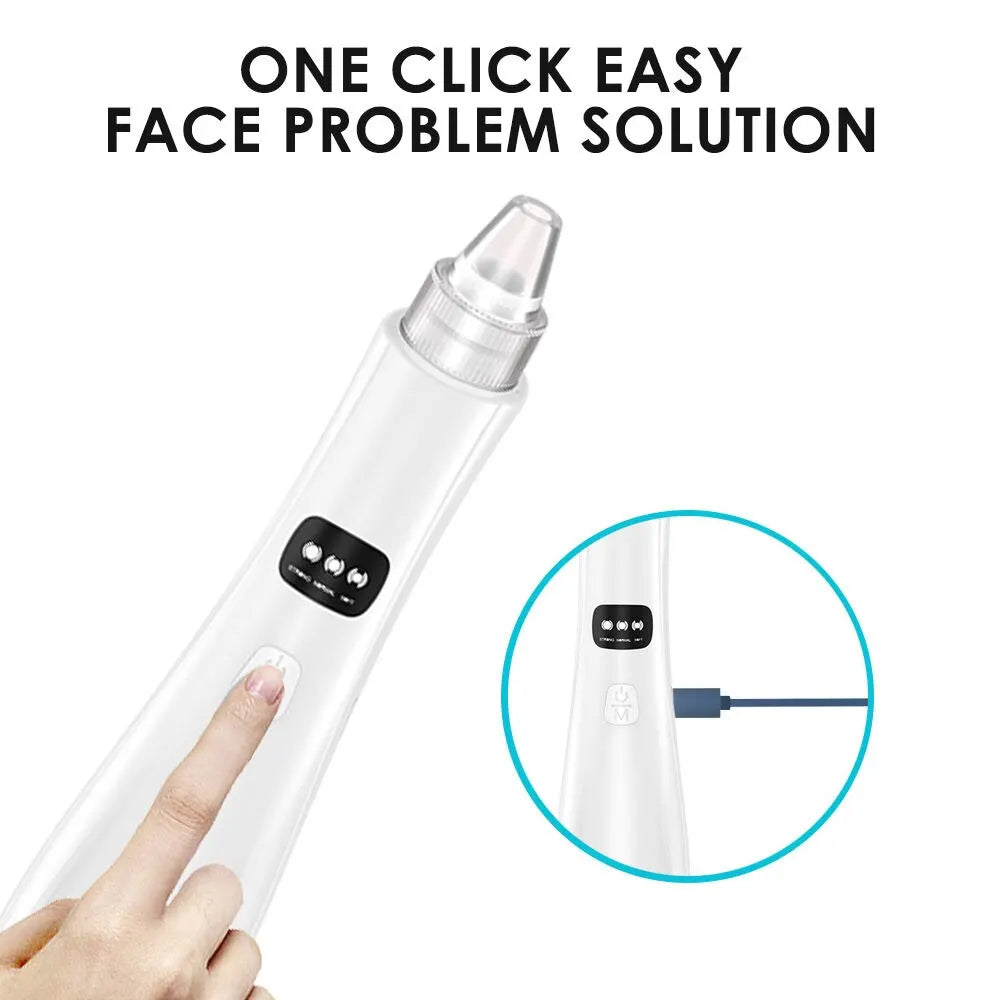 Blackhead Removal