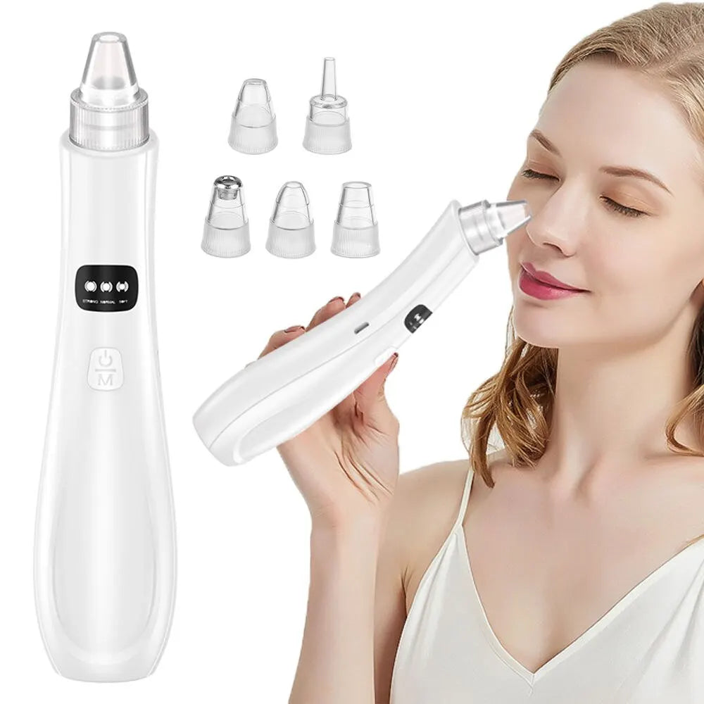 Blackhead Removal